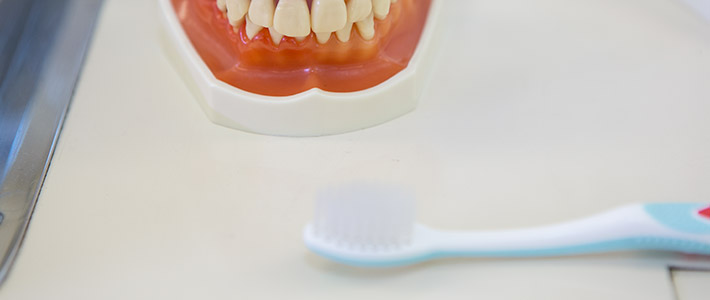 Zahnmodell und Zahnbürste